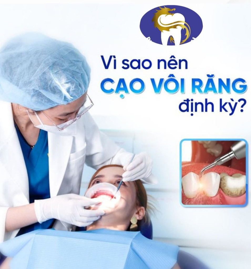 Vì sao nên cạo vôi răng định kỳ? 4 lợi ích thiết thực bạn không nên bỏ qua